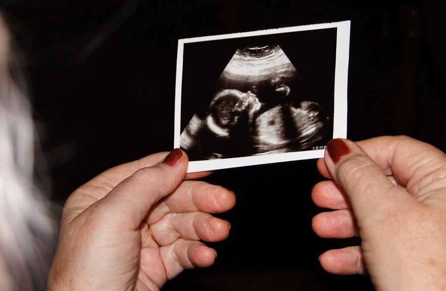 Frauenhände halten Ultraschallbild